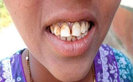 Image used for representational purpose