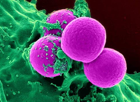 Japan okays controversial research using human cells in animals