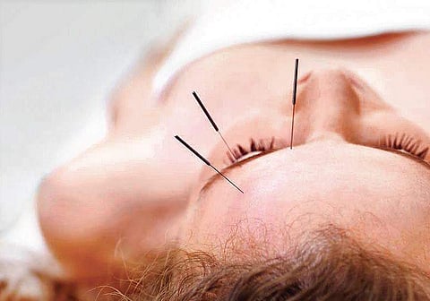 Treating Ocular Ailments with Acupuncture