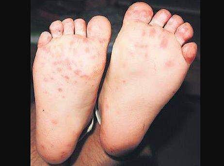 Representational image.