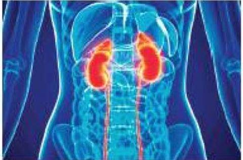 Tripping over urinary stones