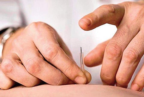 Chronic Fatigue Can be Cured with Acupuncture 