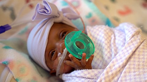 Sharp Mary Birch Hospital for Women & Newborns said on Wednesday that Saybie, born at 23 weeks and three days, is believed to be the world's tiniest surviving baby, who weighed just 245 grams before she was discharged as a healthy infant (photo | AP)