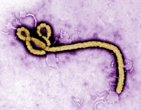 This is an undated colorised transmission electron micrograph file image made available by the CDC shows an Ebola virus virion. (File photo | AP)