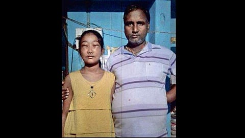 Bibhabari Samal is battling with a rare disease forcing her eyes to remain shut