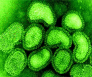 H1N1 virus