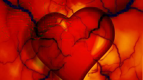 Reprsentational image.