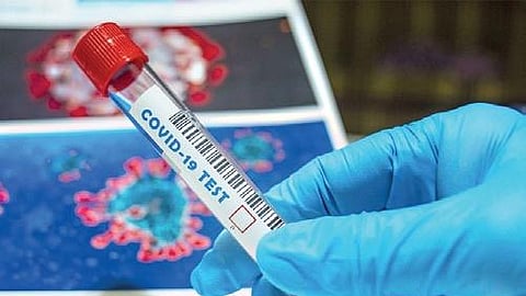 Representative image