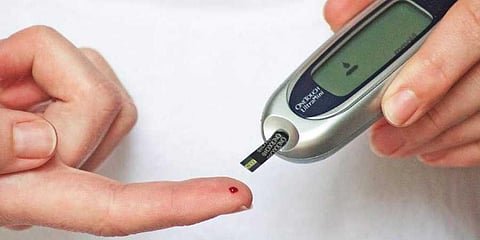 Most of the diabetic patients are having obesity and co-morbid conditions. (Representational Image)
