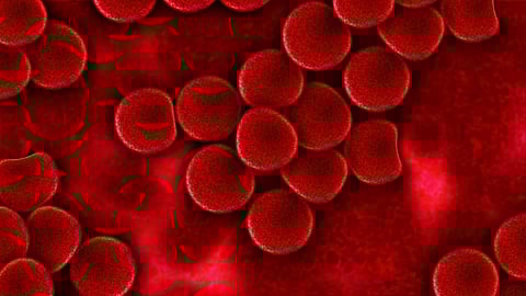 Sickle cell anaemia is a genetic disease of the red blood cells.