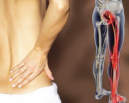 For representational purposes