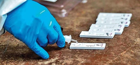 Image used for representational purpose only (File Photo)