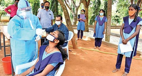 For representational purposes