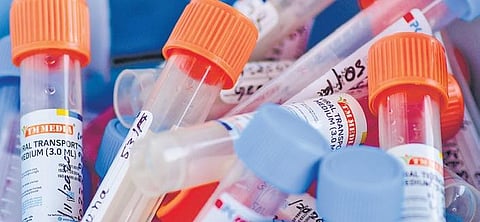 For representational purposes