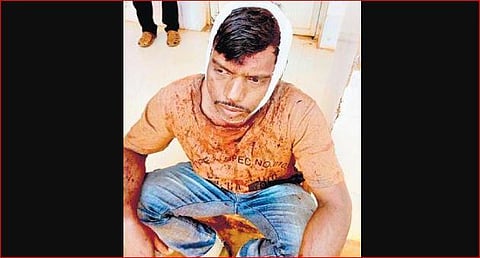 A forest official injured in an attack by stone mafia at Karadabani quarry on Saturday | Express