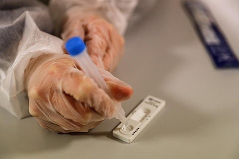 Representative Image.