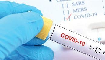 For representational purposes