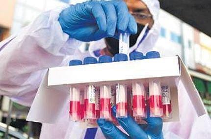 For representational purposes