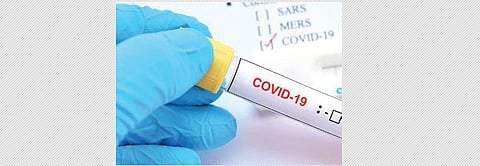 For representational purposes