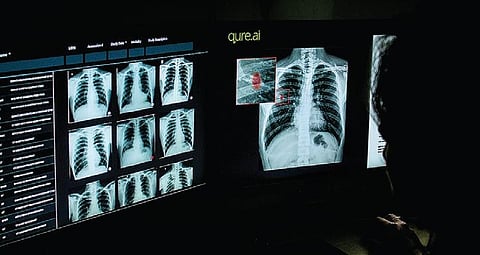 Representational photo. (File Photo| EPS)