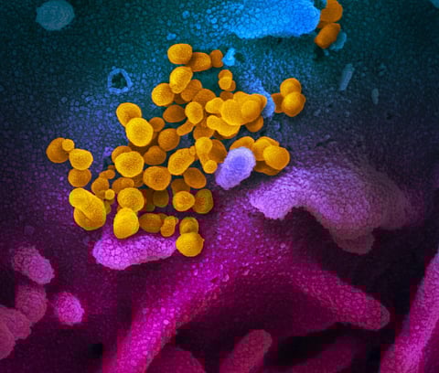 In this picture, the virus, 2019 - nCoV (coloured yellow) can be seen emerging from cultured cells (coloured blue and pink) which were isolated from an affected patient. The virus, first identified in China on December 31, has killed more than 1,400 peopl