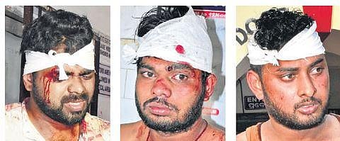 The three injured Congress workers | Express
