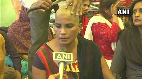 A guest lecturer got her head tonsured in Madhya Pradesh's Bhopal as a protest against state govt,demanding regularisation of job. (Photo | ANI)