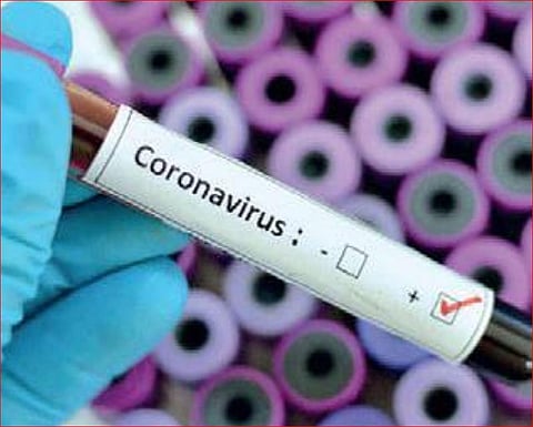 For representational purposes