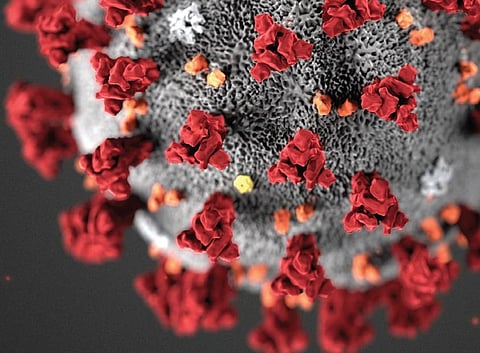 For representational purposes