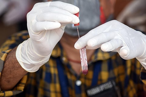 A medic works on a sample for COVID-19 rapid test center in Bhubaneswar. (Photo | Biswanath Swain, EPS)