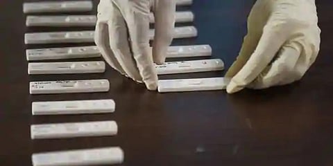 Three held, 954 rapid test kits seized in Nuzvid