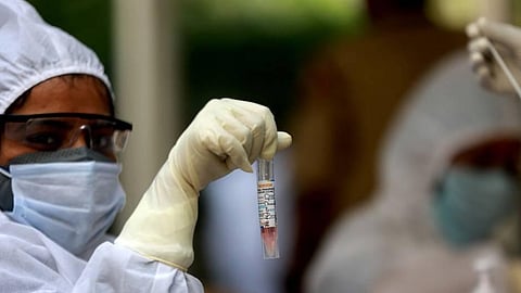 Representational image.