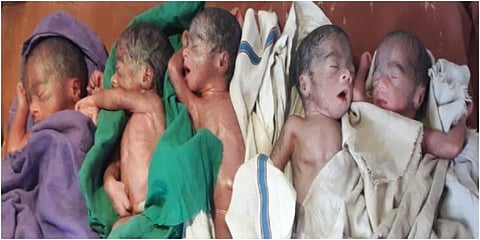 Woman gives birth to five babies in UP's Barabanki