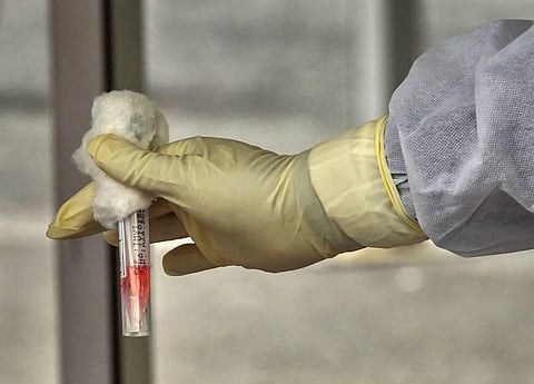 The results are also supported by the fact that both SARS-CoV-2 and the hepatitis C virus are a virus of the same type. (File photo | PTI)