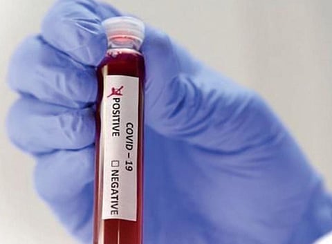 The situation will be reviewed again in the next three days in Sikkim. (Representational Photo)