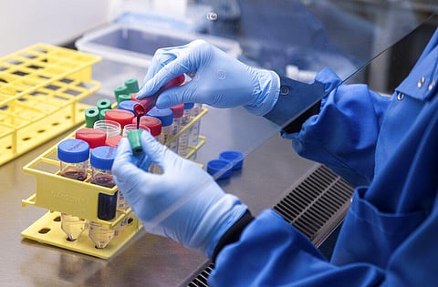 CDC antibody tests show COVID-19 rates 10 times higher than reported cases in US