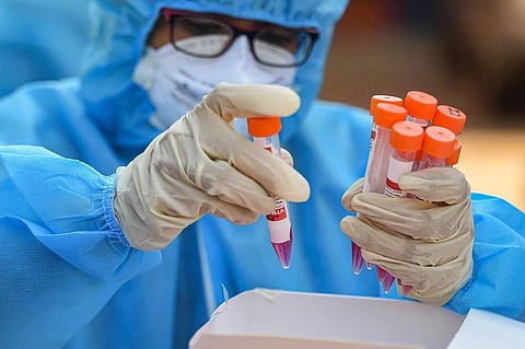 A health worker arranges tubes containing swab samples in a tray for COVID-19 test at a medical camp Kasimedu fish market in Chennai Saturday July 25 2020. (Photo | PTI)