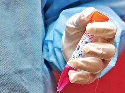 Low antibodies among recovered, doctors in shock