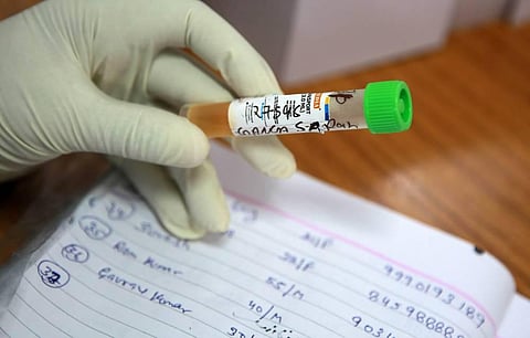 A health worker labels a COVID-19 rapid antigen test in New Delhi. (Photo | Shekhar Yadav, EPS)
