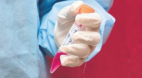 Fear of catching virus again, resistance from family members: Covid survivors in Mysuru wary of plasma donation