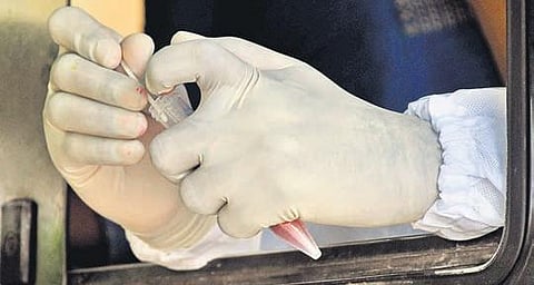 A health worker carefully handling a swab sample in Vijayawada. (Photo | Prasant Madugula, EPS)