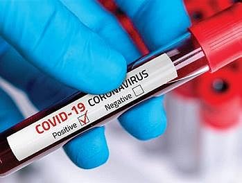 For representational purposes