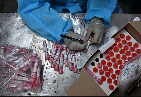 VTMs consisting of samples collected from people for coronavirus test in Vijayawada on Friday. (Photo | Prasant Madugula, EPS)