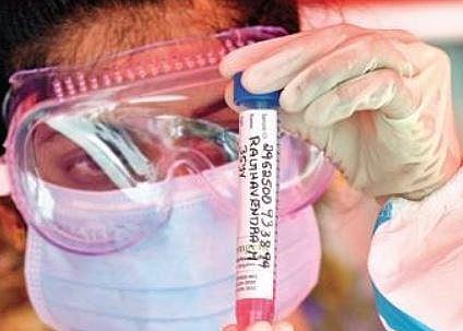 A health worker looks at a Covid  sample in Bengaluru | vinod Kumar T