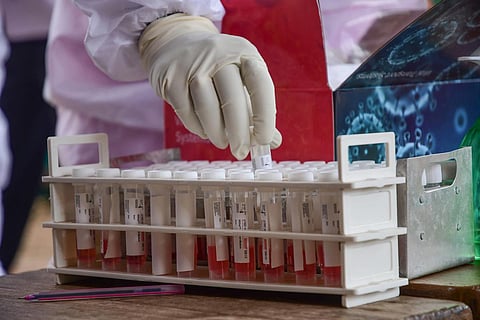 Image for representational purpose only. ( File | EPS)