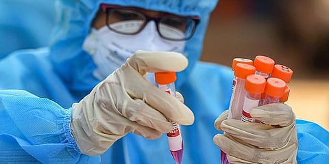 A health worker arranges tubes containing swab samples in a tray for COVID-19 test at a medical camp Kasimedu fish market in Chennai. (File photo | PTI)