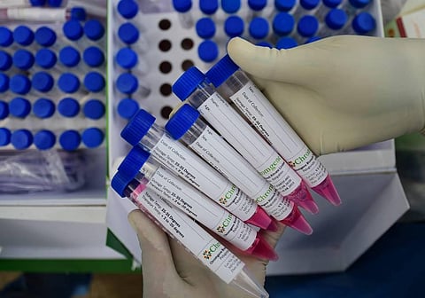 Health Worker holding Colleceted Swab tube near Victoria Hospital in Bengaluru on Saturday. (Photo | Shriram BN/EPS)