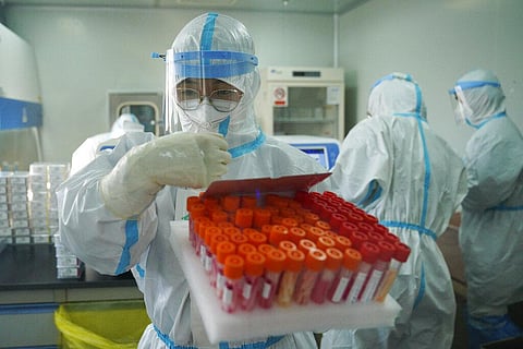 Yang Hongke checks on test samples at a testing lab of KingMed Diagnostics Group Co., Ltd. in Shijiazhuang in northern China's Hebei Province. (Photo | AP)