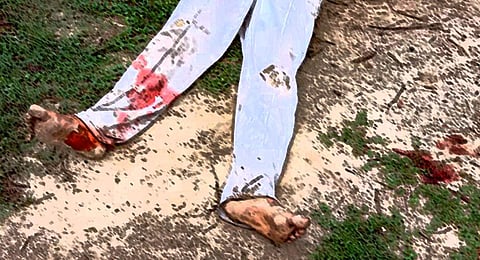 Though there was full public movement, the killers did not bother. (Representational Image)