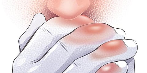 Do not ignore seasonal swellings